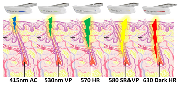 キセノン光線治療器「ビオラV30」